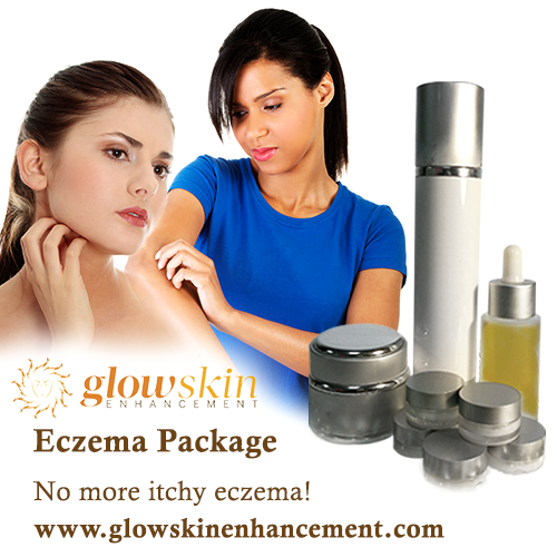 Treat Your Eczema