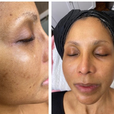 VIP WOMEN'S LA GLOW TREATMENT & SPA PACKAGE KIT Glow Skin Enhancement