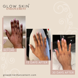 HAND-FEET, KNEE-ELBOW RENEWAL KIT