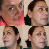 MELASMA VANISHER NIGHT CREAM