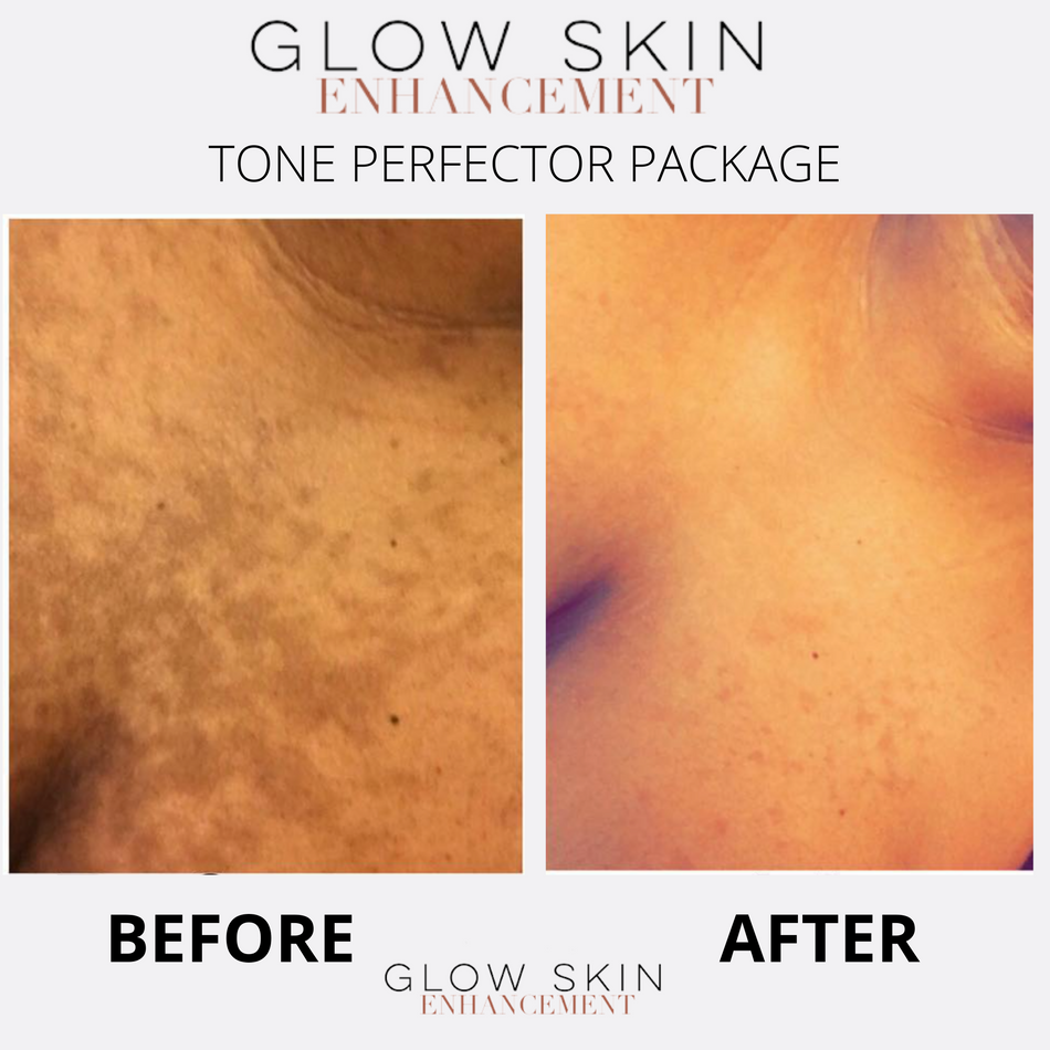 TONER PERFECTOR PACKAGE