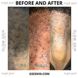 MEN'S GLOW PACKAGE