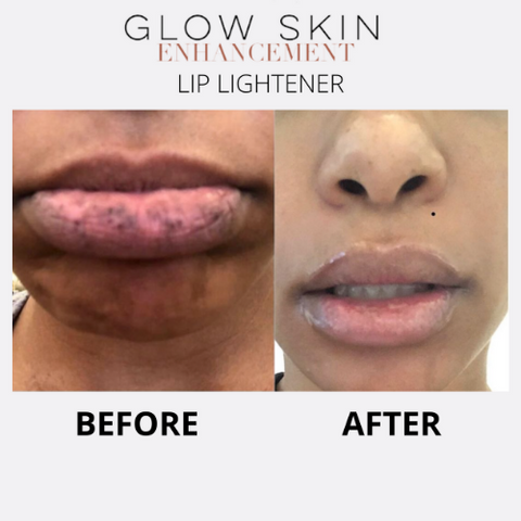 LIP LIGHTENER