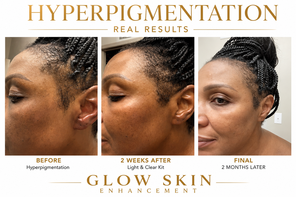 LIGHT + CLEAR PACKAGE (DAY/NIGHT)