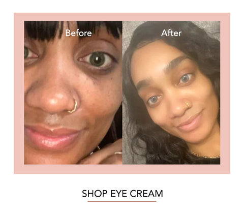DARK CIRCLE REMOVER EYE CREAM