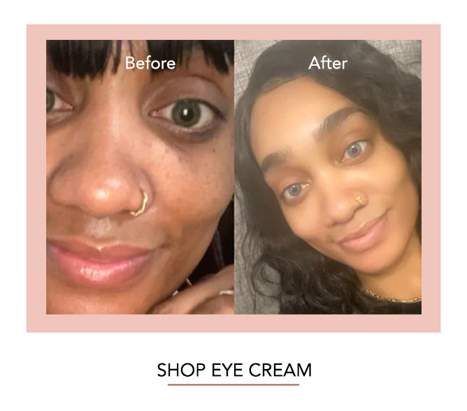DARK CIRCLE REMOVER EYE CREAM