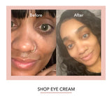 EYE Cream (DARK CIRCLE REMOVER)