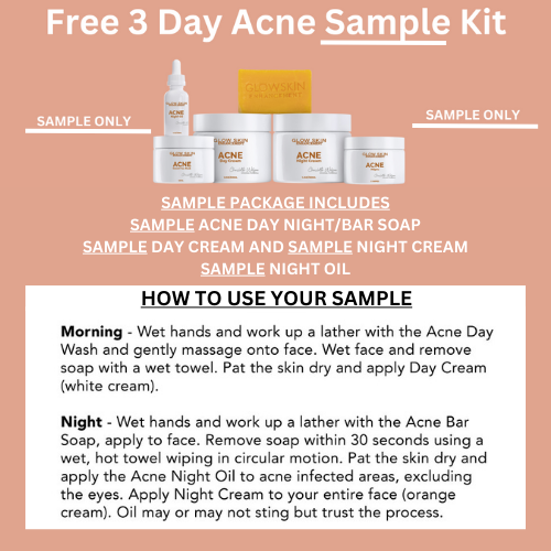 Acne 3 DAY Sample Package Free
