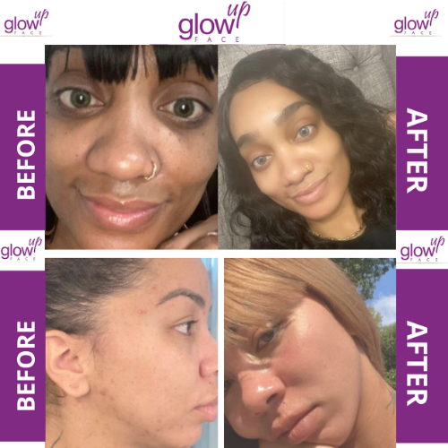 GlowUP Kit– Glow Skin Enhancement