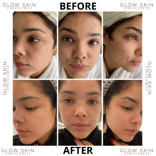 LIGHT & CLEAR PACKAGE (DAY/NIGHT)– Glow Skin Enhancement