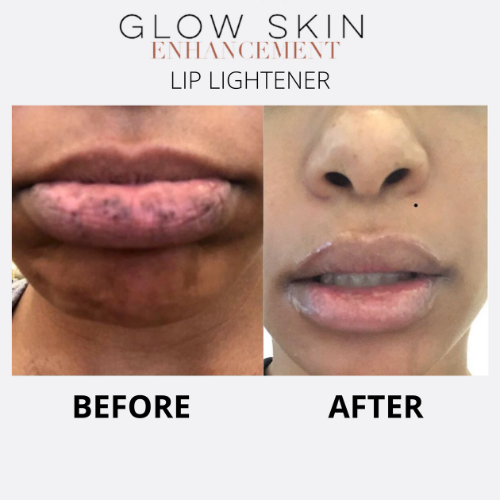 LIP LIGHTENER Glow Skin Enhancement